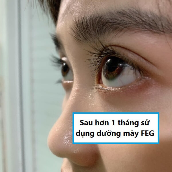 Đ&acirc;y l&agrave; l&ocirc;ng m&agrave;y của m&igrave;nh sau 1 th&aacute;ng d&ugrave;ng &ldquo;em dưỡng&rdquo; n&agrave;y.