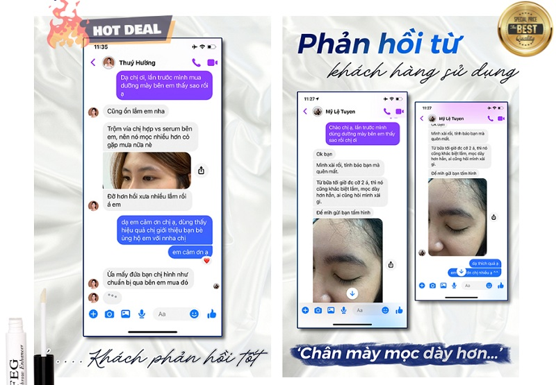 Phản hồi của kh&aacute;ch h&agrave;ng khi sử dụng dưỡng m&agrave;y FEG