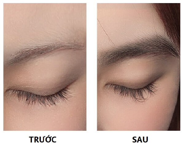 duong-may-feg-truoc-va-sau